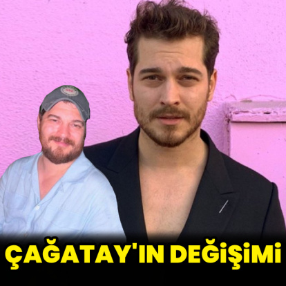 Çağatay Ulusoy'un değişimi
