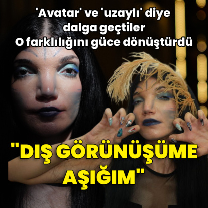 'Avatar' diye dalga geçtiler, o farklılığını güce dönüştürdü