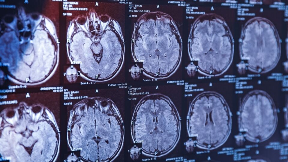 Mucize peptit çağı başlıyor