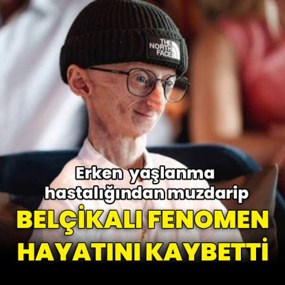 Belçikalı fenomen genetik hastalığı nedeniyle hayatını kaybetti