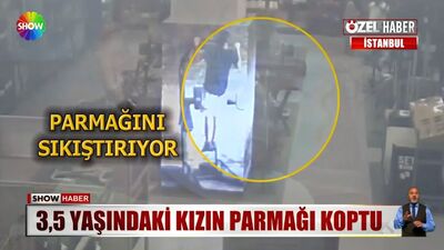 Amara'nın parmağının koptuğu anlar kamerada