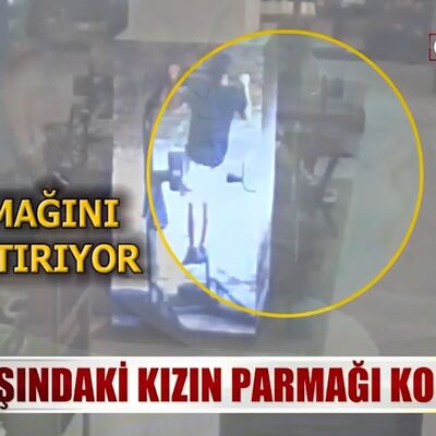 Amara'nın parmağının koptuğu anlar kamerada