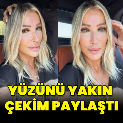 Yüzünü yakın çekim paylaştı
