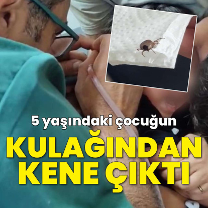 Kulak ağrısı diye gitti, kulağından kene çıktı!