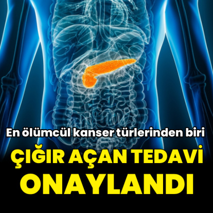 ABD, pankreas kanserinde çığır açan tedaviyi onayladı
