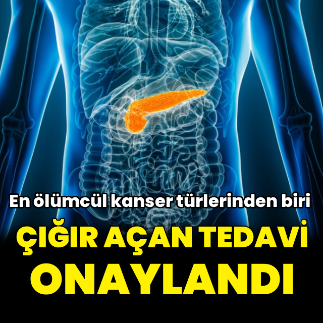 ABD, pankreas kanserinde çığır açan tedaviyi onayladı