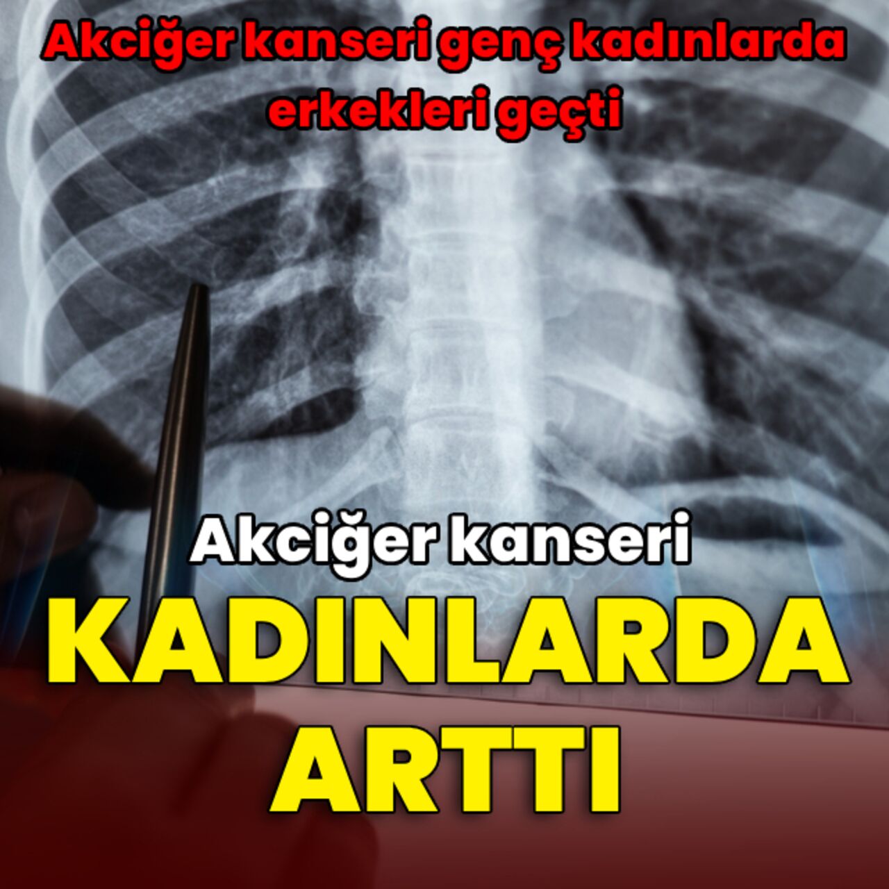 Akciğer kanseri kadınlarda artıyor