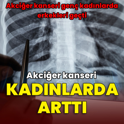 Akciğer kanseri kadınlarda artıyor 