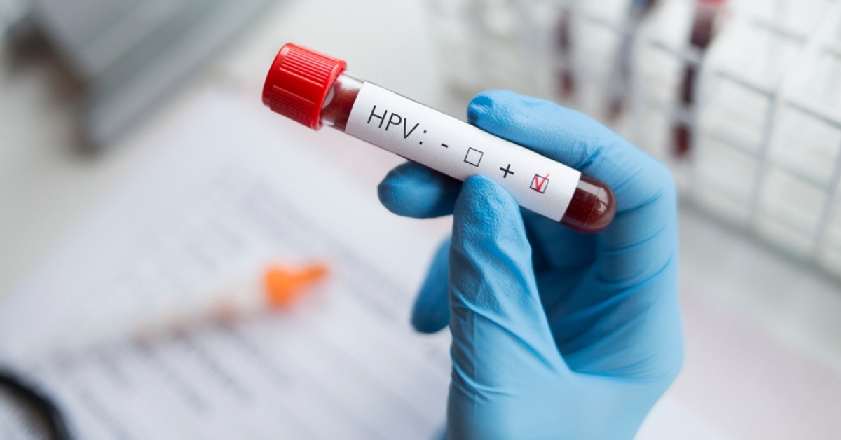 HPV tehlikesi ne kadar yaygın?