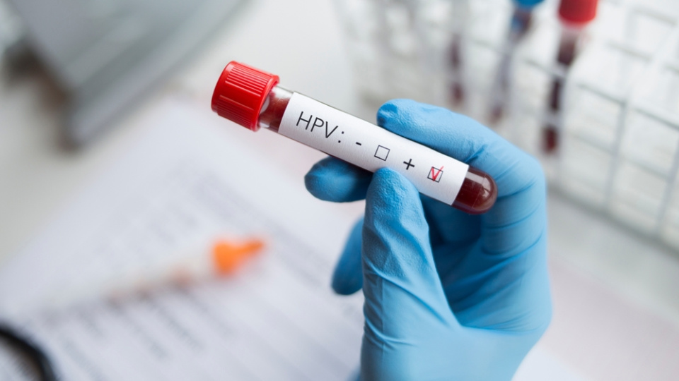 HPV tehlikesi ne kadar yaygın?