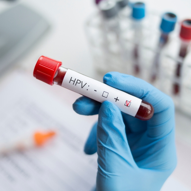 HPV tehlikesi ne kadar yaygın?