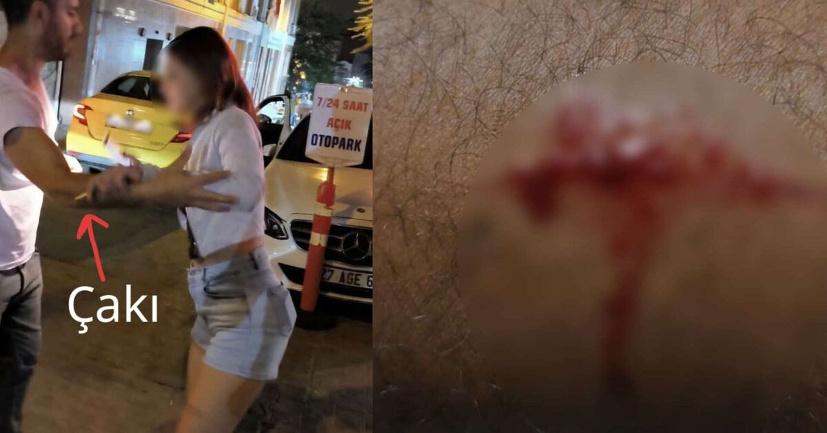 “Takside gasp” iddiasının perde arkası