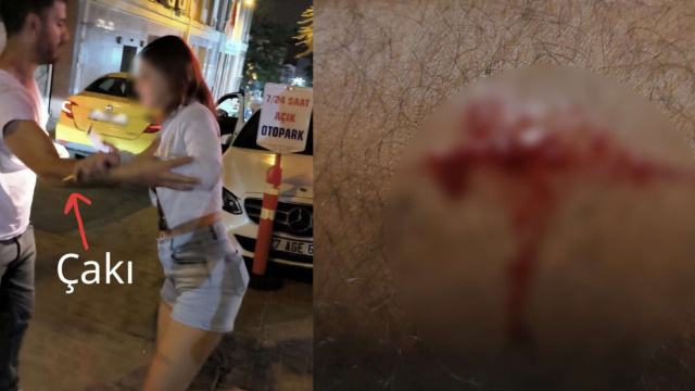 "Takside gasp" iddiasının perde arkası