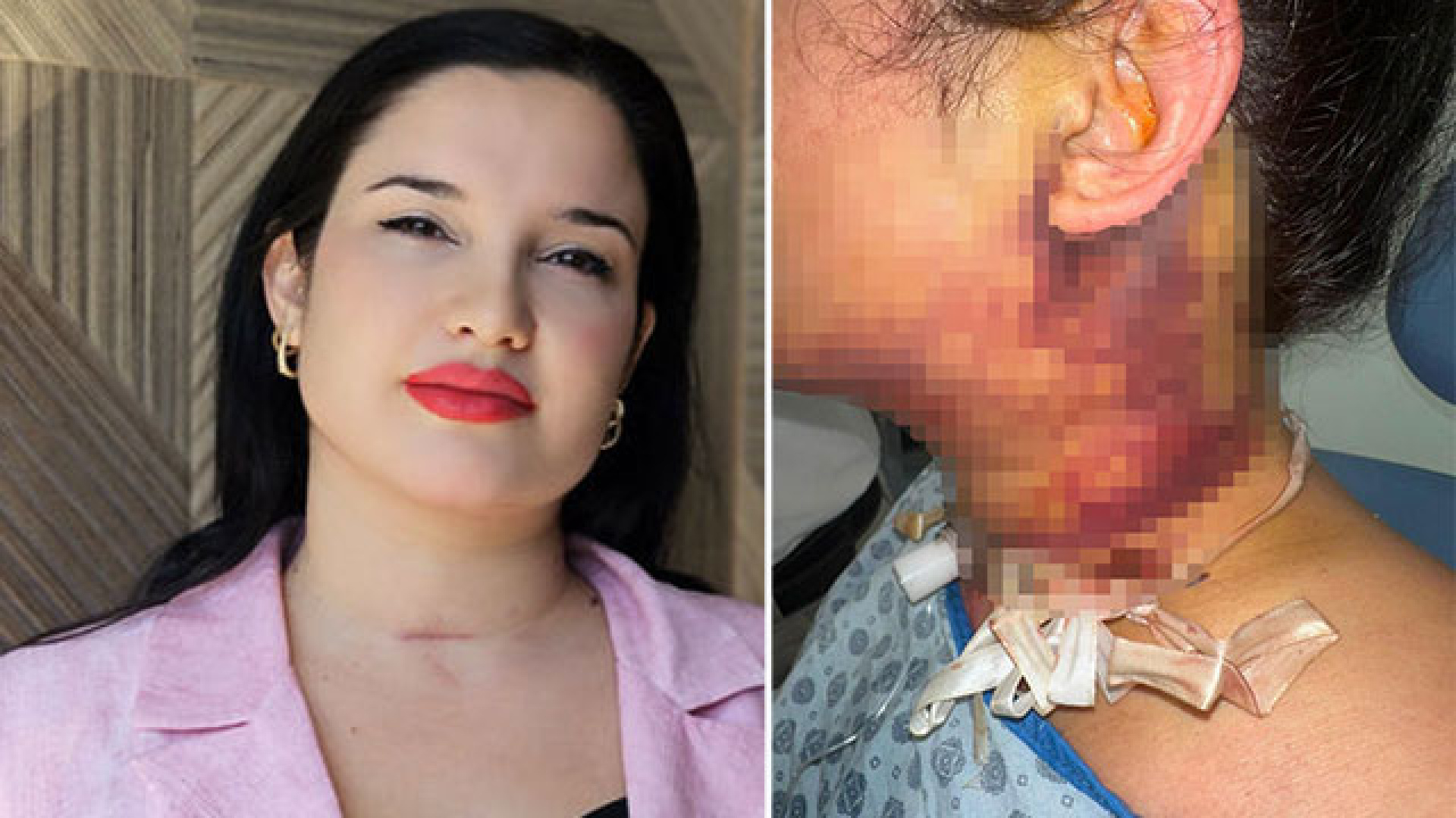 Estetik operasyonu kâbusla son buldu! haber görseli