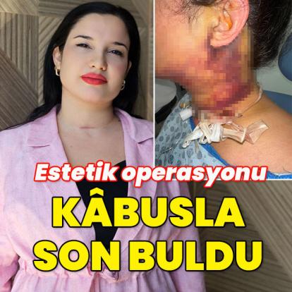 Estetik operasyonu kâbusla son buldu!