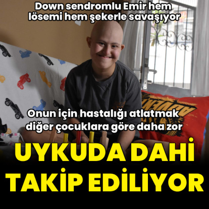 Down sendromlu Emir Enes hem lösemi hem şekerle savaşıyor