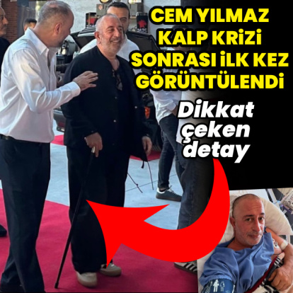 Cem Yılmaz'dan 'baston' açıklaması