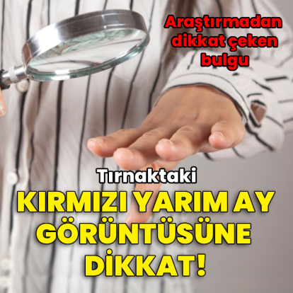 Araştırma: Tırnak diplerindeki kırmızı ay görüntüsüne dikkat!
