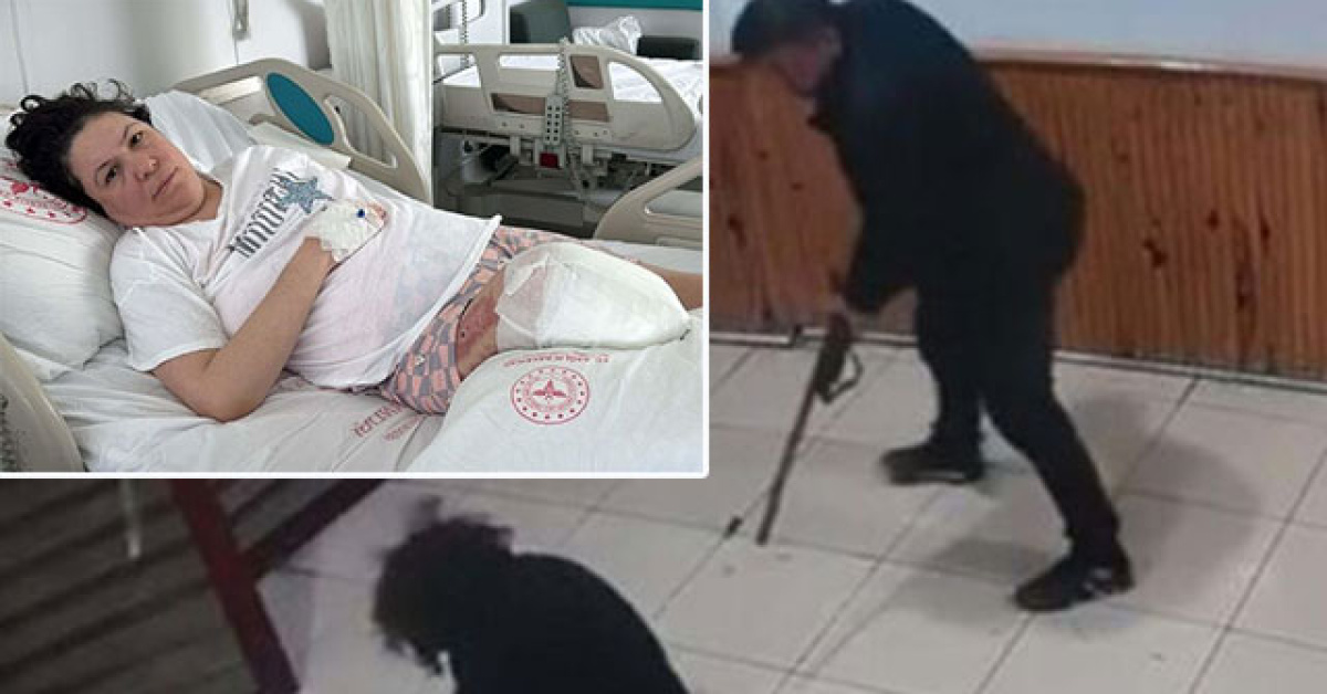 Eşinin saldırısında sol bacağını kaybetmişti! Bir acı haber daha geldi