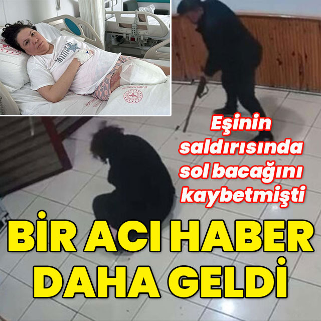 Eşinin saldırısında sol bacağını kaybetmişti! Bir acı haber daha geldi