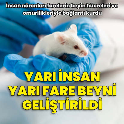 Yarı insan yarı fare beyni geliştirildi