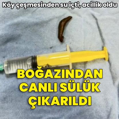Köy çeşmesinden su içti, acillik oldu! Boğazından canlı sülük çıkarıldı
