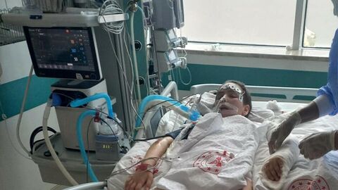 Doktorların yüzde 10 yaşama şansı verdiği Almina, hayata tutundu | Hatay Masası | Haberler analizi
