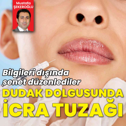 Dudak dolgusunda icra tuzağı!