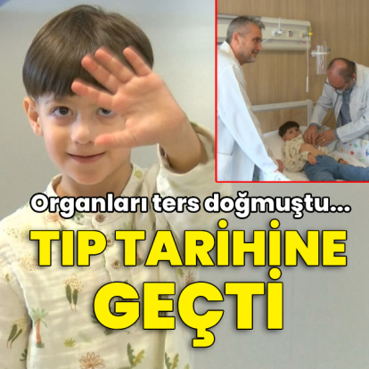 Organları ters doğmuştu! Tıp tarihine geçti