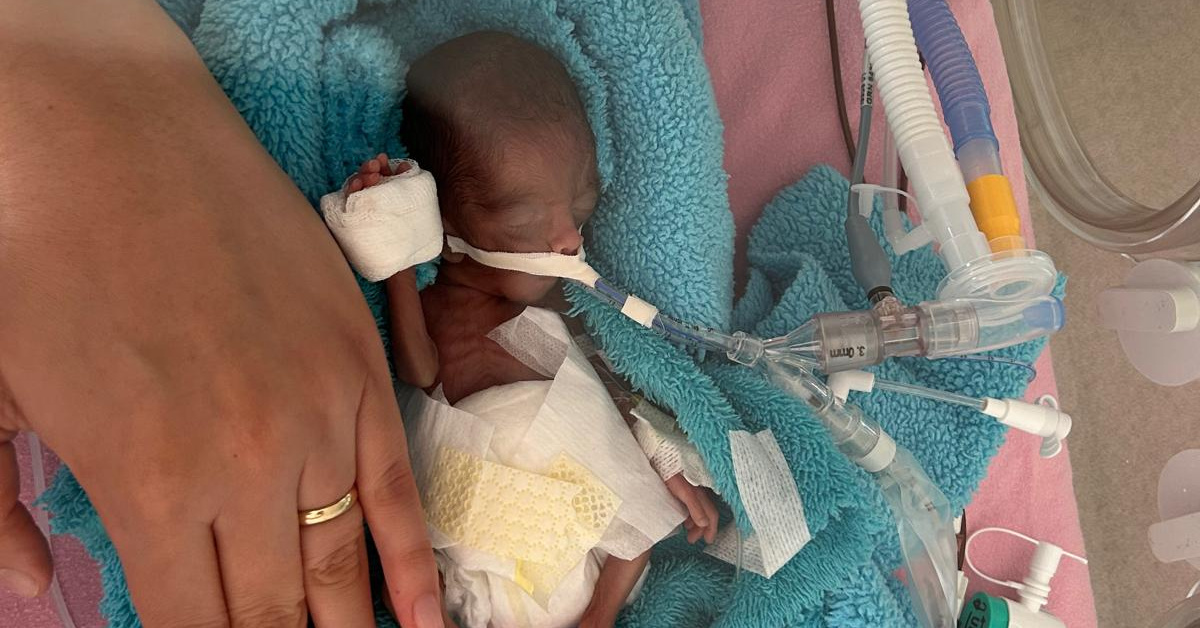350 gram doğmuştu! Rüzgar bebek 240 gün sonra yaşam mücadelesini kazandı