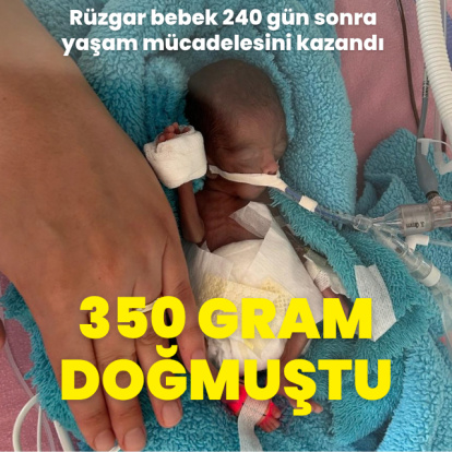 350 gram doğmuştu! Rüzgar bebek 240 gün sonra yaşam mücadelesini kazandı