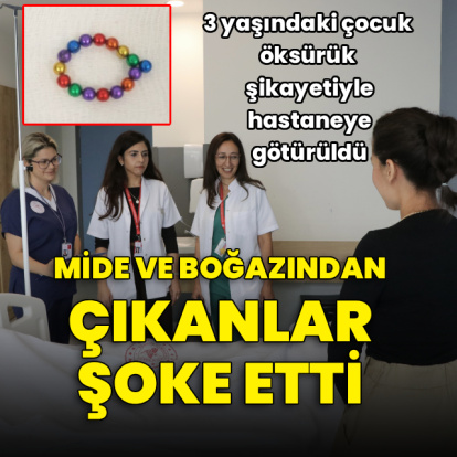 Öksürük şikayetiyle hastaneye götürüldü! Mide ve boğazından çıkanlar şoke etti