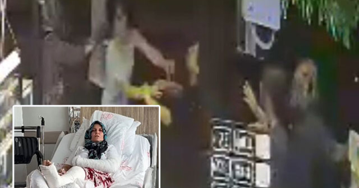 Kavgada 3 çocuk annesinin kolu ve bacağı kırıldı