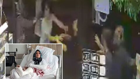 Kavgada 3 çocuk annesinin kolu ve bacağı kırıldı
