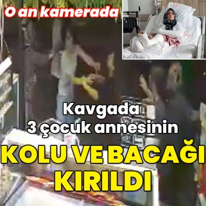 Kavgada 3 çocuk annesinin kolu ve bacağı kırıldı