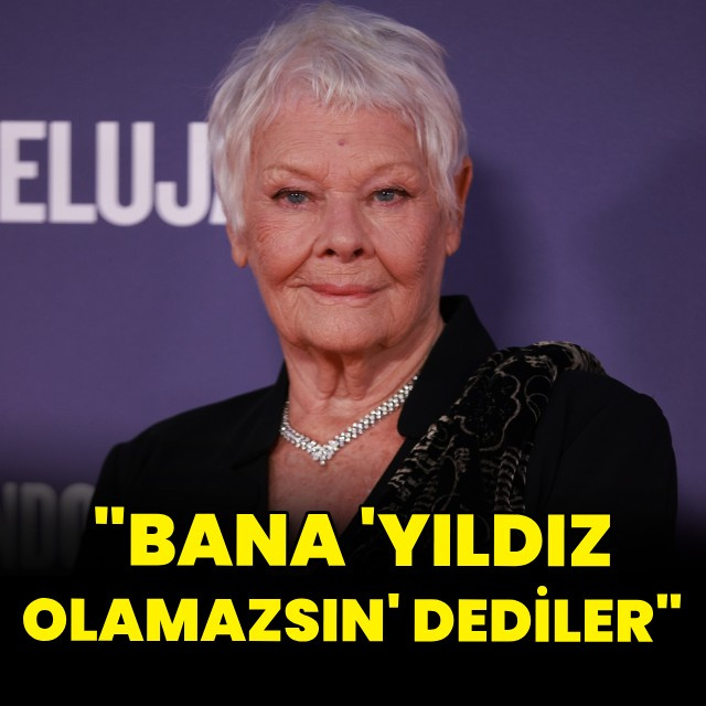 "Bana 'Yıldız olamazsın' dediler"