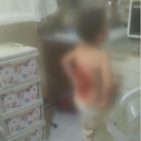 Akran zulmü! Çocuğun sırtını kolonya ile yaktılar