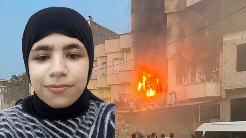 Gaziantep’in Nizip ilçesinde 6 Ekim’de bir evde çıkan yangında ağır yaralanan 1