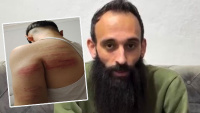SON DAKİKA HABERİ: 2 çırağını demir sopayla dövdü! Tuvalete kilitleyip temizlik yaptırdı | Son dakika haberleri