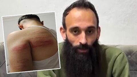 Günün notu | Berber şiddeti! 2 çırağını demir sopayla dövdü