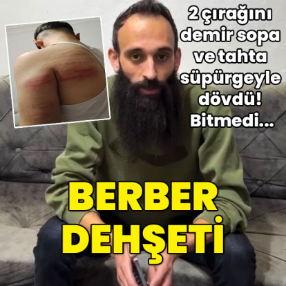 Berber şiddeti! 2 çırağını demir sopayla dövdü