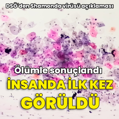 Shamonda virüsü insanda görüldü! DSÖ'den açıklama