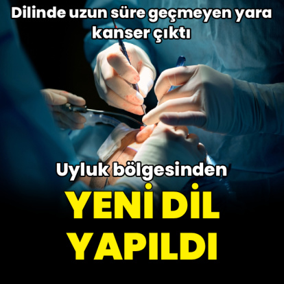Dil kanseri olan hastaya uyluk bölgesinden yeni dil yapıldı