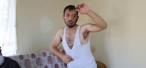 Hidradenitis hastası Enver tedavi olmak istiyor
Baba Servet Dağtekin:
"Evla...