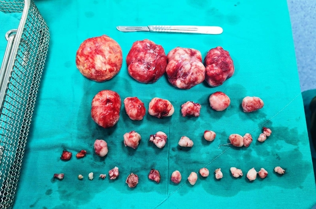 hastanin rahminden 38 miyom cikti eskisehir ozel umit visnelik hastanesi kadin hastaliklari ve dogum uzmani op