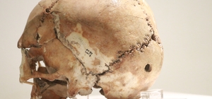 Dünyanın ilk beyin ameliyatı 10 bin 500 yıl önce Aksaray'da yapıldı
Beyin a...