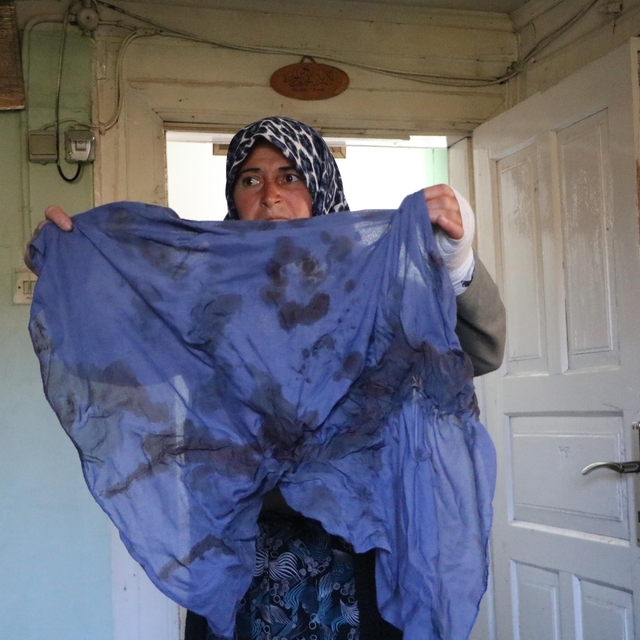 Köyde hayvanları otlatma kavgasında darbedildi