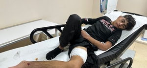 Erzurum'da bozayı saldırısına uğrayan 16 yaşındaki çocuk yaralandı