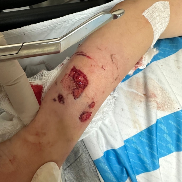 12 yaşındaki çocuk, sevdiği köpeğin saldırısında yaralandı