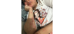 Eczacının otizmli Zeynep'e verdiği muadil ilaç alerjik etki yaptı; baba şik...